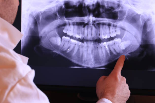 Best Dental Abscess Treatment in Newberry, MI